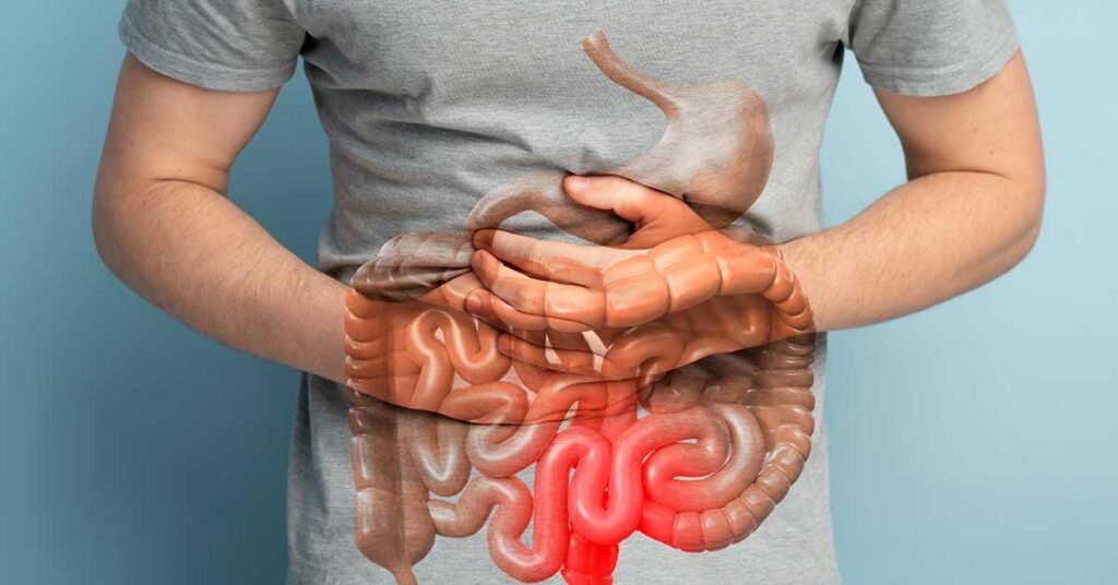 Intestino preso Gordura no fígado | Dr. Octávio Rodrigues | Gastro