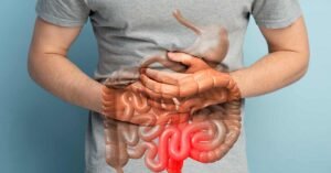Intestino preso Gordura no fígado | Dr. Octávio Rodrigues | Gastro