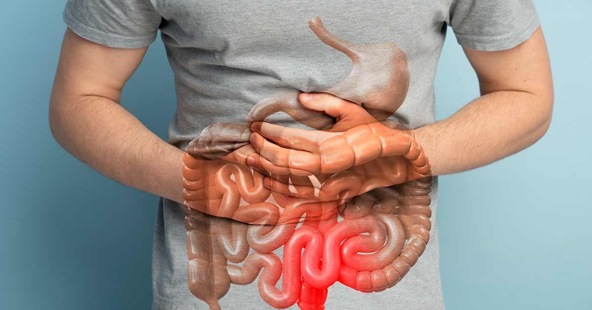 Intestino preso Gordura no fígado | Dr. Octávio Rodrigues | Gastro