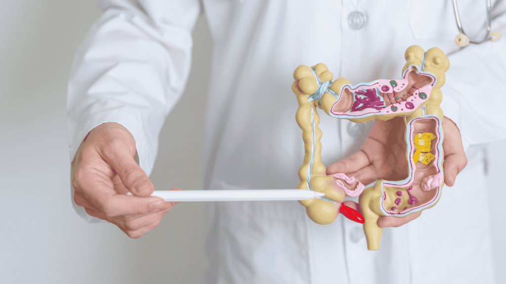 Diverticulose e Diverticulite | Dr. Octávio Rodrigues | Gastroenterologista