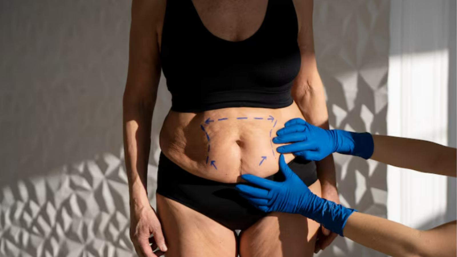 Obesidade como Doença | Dr. Octávio Rodrigues